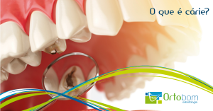 o-que-e-carie-blog-ortobom-odontologia-curitiba-franquia-dentista